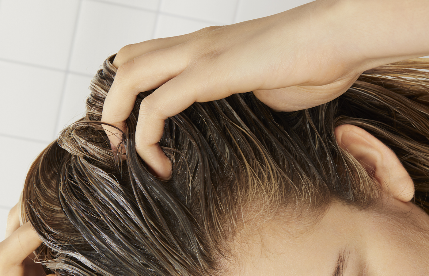 Unhealthy Scalp Can Lead to Thinning Hair: Here's How